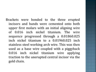 Brackets were bonded to the three erupted
incisors and bands were cemented onto both
upper first molars with an initial aligning wire
of 0.016 inch nickel titanium. The wire
sequence progressed through a 0.01860.025
inch nickel titanium to a 0.01960.025 inch
stainless steel working arch wire. This was then
used as a base wire coupled with a piggyback
0.016 inch nickel titanium wire applying
traction to the unerupted central incisor via the
gold chain.
 