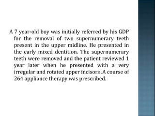 A 7 year-old boy was initially referred by his GDP
for the removal of two supernumerary teeth
present in the upper midline. He presented in
the early mixed dentition. The supernumerary
teeth were removed and the patient reviewed 1
year later when he presented with a very
irregular and rotated upper incisors .A course of
264 appliance therapy was prescribed.
 