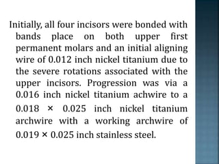 Initially, all four incisors were bonded with
bands place on both upper first
permanent molars and an initial aligning
wire of 0.012 inch nickel titanium due to
the severe rotations associated with the
upper incisors. Progression was via a
0.016 inch nickel titanium achwire to a
0.018 × 0.025 inch nickel titanium
archwire with a working archwire of
0.019 × 0.025 inch stainless steel.
 