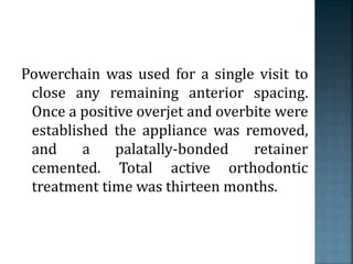Powerchain was used for a single visit to
close any remaining anterior spacing.
Once a positive overjet and overbite were
established the appliance was removed,
and a palatally-bonded retainer
cemented. Total active orthodontic
treatment time was thirteen months.
 