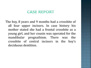 The boy, 8 years and 9 months had a crossbite of
all four upper incisors. In case history his
mother stated she had a frontal crossbite as a
young girl, and her cousin was operated for the
mandibular prognathism. There was the
crossbite of central incisors in the boy's
deciduous dentition.
 