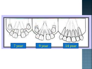 7 year 9 year 14 year
 