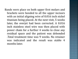 Bands were place on both upper first molars and
brackets were bonded to all the upper incisors
with an initial aligning wire of 0.016 inch nickel
titanium being placed. At the next visit, 5 weeks
later, the overjet had been corrected. A 0.016
inch stainless steel wire was then placed with
power chain for a further 4 weeks to close any
residual space and the patient was debonded
.Total treatment time was 9 weeks. No retainer
was indicated and the result was stable 4
months later.
 