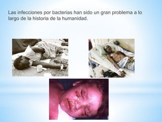 Las infecciones por bacterias han sido un gran problema a lo 
largo de la historia de la humanidad. 
 