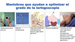 Intubation Ramping SECUENCIA DE INTUBACIÓN RÁPIDA.pptx