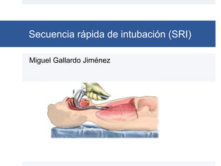Secuencia rápida de intubación (SRI)
Miguel Gallardo Jiménez
 