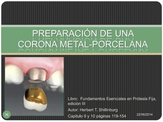 Preparación terminada para corona metal porcelana.