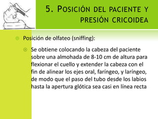 5. Posición del paciente y presión cricoideaPosición de olfateo (sniffing):Se obtiene colocando la cabeza del paciente  sobre una almohada de 8-10 cm de altura para flexionar el cuello y extender la cabeza con el fin de alinear los ejes oral, faríngeo, y laríngeo, de modo que el paso del tubo desde los labios hasta la apertura glótica sea casi en línea recta 