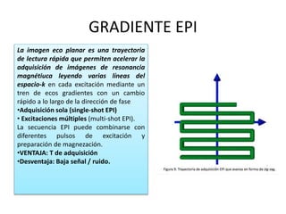 Secuencias en RM | PPTX