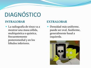 DIAGNÓSTICO
INTRALOBAR EXTRALOBAR
 La radiografía de tórax va a
mostrar una masa sólida,
multiquística o quística,
frecuentemente
posteromedial y en los
lóbulos inferiores.
 Densidad más uniforme,
puede ser oval, fusiforme,
generalmente basal a
izquierda.
 
