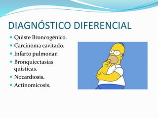 DIAGNÓSTICO DIFERENCIAL
 Quiste Broncogénico.
 Carcinoma cavitado.
 Infarto pulmonar.
 Bronquiectasias
quísticas.
 Nocardiosis.
 Actinomicosis.
 