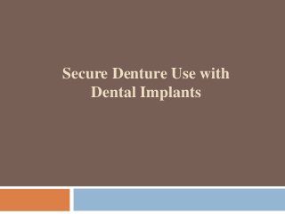 Secure Denture Use with 
Dental Implants 
 