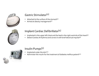 Gastric Stimulator[2] 
• Attached to the surface of the stomach[7] 
• Aimed at obesity management[7] 
Implant Cardiac Defibrillator[4] 
• Implanted in the upper left chest and the lead in the right ventricle of the heart[9] 
• Detect Cardiac Arrhythmia and correct it with brief electrical impulse[9] 
Insulin Pumps[5] 
• Implanted under the skin[10] 
• Administer the insulin for the treatment of diabetes mellitus patient[10] 
 