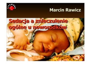Marcin Rawicz

Sedacja a znieczulenie
ogólne u noworodków
 