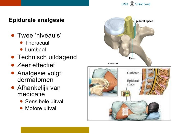 Sedatie en analgesie op de ic