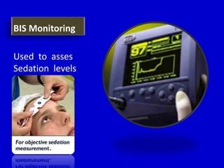 BIS Monitoring 
Used to asses 
Sedation levels 
 