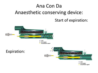 Ana Con Da
Anaesthetic conserving device:
Start of expiration:
Expiration:
 