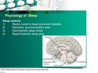 Physiology of Sleep
Sleep centres:
1) Raphe nuclei in lower pons and medulla
2) Medullary synchronization area
3) Diencephalic sleep areas
4) Basal forebrain sleep area
4http://images.google.com/imgres?imgurl=brain-control-center-320
 