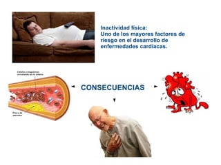 Inactividad física:  Uno de los mayores factores de riesgo en el desarrollo de enfermedades cardíacas. CONSECUENCIAS 