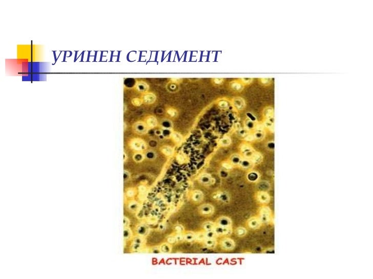 Изследване на урина, уринен седимент, хематурия (диагностични аспекти)