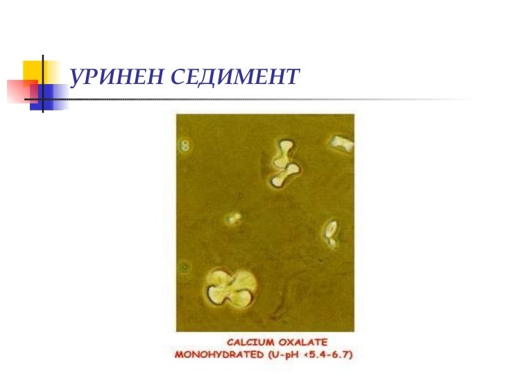 Изследване на урина, уринен седимент, хематурия (диагностични аспекти)
