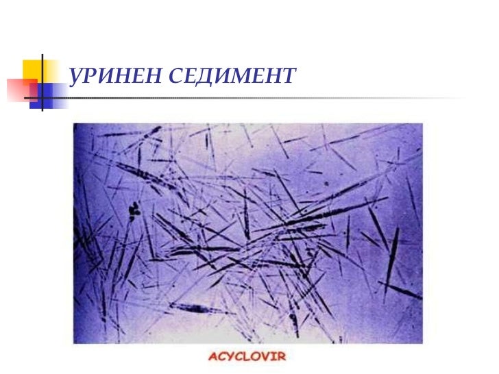 Изследване на урина, уринен седимент, хематурия (диагностични аспекти)