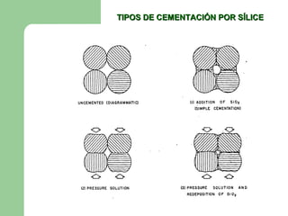 TIPOS DE CEMENTACIÓN POR SÍLICE
 