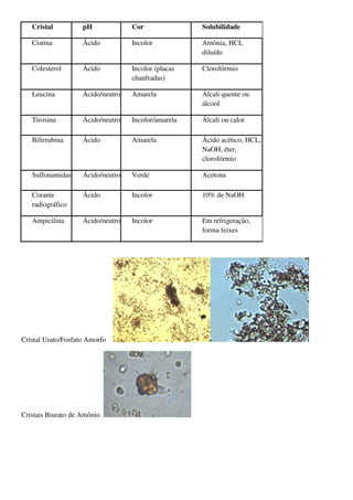 Cristal          pH             Cor               Solubilidade

   Cistina          Ácido          Incolor           Amônia, HCL
                                                     diluído

   Colesterol       Ácido          Incolor (placas   Clorofórmio
                                   chanfradas)

   Leucina          Ácido/neutro   Amarela           Álcali quente ou
                                                     álcool

   Tirosina         Ácido/neutro   Incolor/amarela   Álcali ou calor

   Bilirrubina      Ácido          Amarela           Ácido acético, HCL,
                                                     NaOH, éter,
                                                     clorofórmio

   Sulfonamidas     Ácido/neutro   Verde             Acetona

   Corante          Ácido          Incolor           10% de NaOH
   radiográfico

   Ampicilina       Ácido/neutro   Incolor           Em refrigeração,
                                                     forma feixes




Cristal Urato/Fosfato Amorfo




Cristais Biurato de Amônio
 