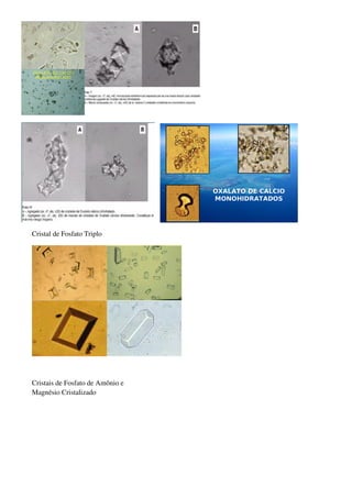 Cristal de Fosfato Triplo




Cristais de Fosfato de Amônio e
Magnésio Cristalizado
 