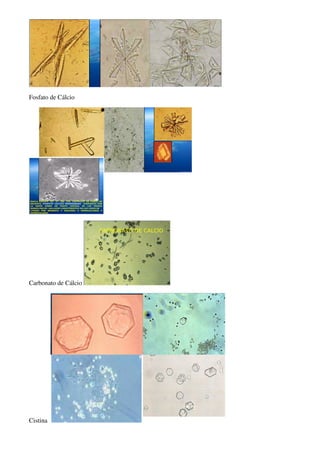 Fosfato de Cálcio




Carbonato de Cálcio




Cistina
 
