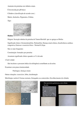 Aumento de proteínas nos túbulos renais

   É favorecida por pH baixo

   Cilindros (classificação de acordo com )

   Matriz, Inclusões, Pigmentos, Células.

   Tipo:




   Hialino

   Origem: Secreção tubular de proteína de Tamm-Horsfall que se agrega as fibrilas

   Significado clinico: Gromerulonefrite, Pielonefrite, Doença renal crônica, Insuficiência cardíaca
   congestiva, Estresse e exercicio físico. Normal 0-2/cpa

   São os mais frequentes

   Constituição: formados por proteína

   Assumem significado clínico quando o nº é elevado

<2 por campo

   São incolores e possuem índice de refringência semelhante ao da urina

Examinar com pouca luminosidade.

           Patologias: doenças renais

Outras situações: exercícios, febre, desidratação

Morfologia variável: Formas normais, Enrugados ou contorcidos, Envelhecimento do cilindro
 