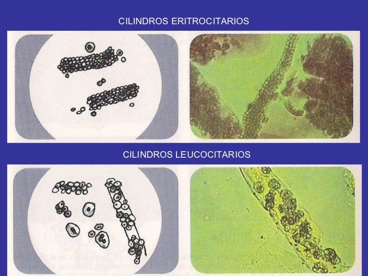 Sedimento Sedimento