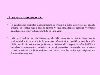 CÉLULAS DE DESCAMACIÓN.
•

En condiciones normales la descamación se produce a todos los niveles del aparato
urinario, de forma más o menos intensa y cuya finalidad es expulsar y reponer
aquellas células que ya han cumplido su ciclo vital.

•

Esta actividad se ve marcadamente alterada tanto en su ritmo como en su
profundidad ante la presencia de procesos inflamatorios o proliferativos, la acción
citotóxica de ciertos microorganismos, la irritante de cuerpos extraños (catéteres,
cálculos) o compuestos químicos y la degenerativa producida por procesos
invasivo-destructivos (tumores) son las causas más frecuentes que originan una
descamación anormal.

 