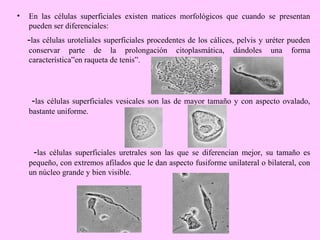 •

En las células superficiales existen matices morfológicos que cuando se presentan
pueden ser diferenciales:

-las células uroteliales superficiales procedentes de los cálices, pelvis y uréter pueden
conservar parte de la prolongación
característica”en raqueta de tenis”.

citoplasmática,

dándoles

una

forma

-las células superficiales vesicales son las de mayor tamaño y con aspecto ovalado,
bastante uniforme.

-las

células superficiales uretrales son las que se diferencian mejor, su tamaño es
pequeño, con extremos afilados que le dan aspecto fusiforme unilateral o bilateral, con
un núcleo grande y bien visible.

 