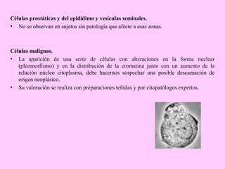 Células prostáticas y del epidídimo y vesículas seminales.
• No se observan en sujetos sin patología que afecte a esas zonas.

Células malignas.
• La aparición de una serie de células con alteraciones en la forma nuclear
(pleomorfismo) y en la distribución de la cromatina junto con un aumento de la
relación núcleo citoplasma, debe hacernos sospechar una posible descamación de
origen neoplásico.
• Su valoración se realiza con preparaciones teñidas y por citopatólogos expertos.

 
