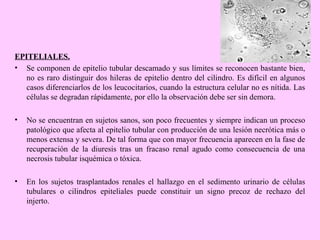 EPITELIALES.
• Se componen de epitelio tubular descamado y sus límites se reconocen bastante bien,
no es raro distinguir dos hileras de epitelio dentro del cilindro. Es difícil en algunos
casos diferenciarlos de los leucocitarios, cuando la estructura celular no es nítida. Las
células se degradan rápidamente, por ello la observación debe ser sin demora.
•

No se encuentran en sujetos sanos, son poco frecuentes y siempre indican un proceso
patológico que afecta al epitelio tubular con producción de una lesión necrótica más o
menos extensa y severa. De tal forma que con mayor frecuencia aparecen en la fase de
recuperación de la diuresis tras un fracaso renal agudo como consecuencia de una
necrosis tubular isquémica o tóxica.

•

En los sujetos trasplantados renales el hallazgo en el sedimento urinario de células
tubulares o cilindros epiteliales puede constituir un signo precoz de rechazo del
injerto.

 
