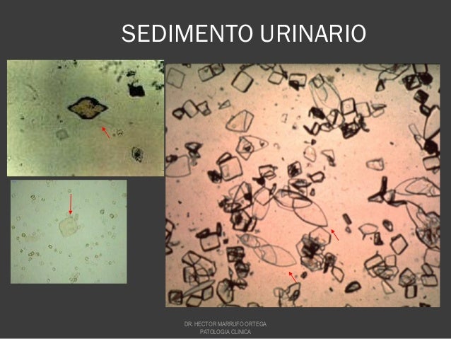 Sedimento urinario 2010