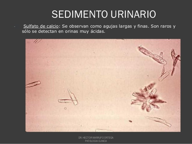 Sedimento urinario 2010