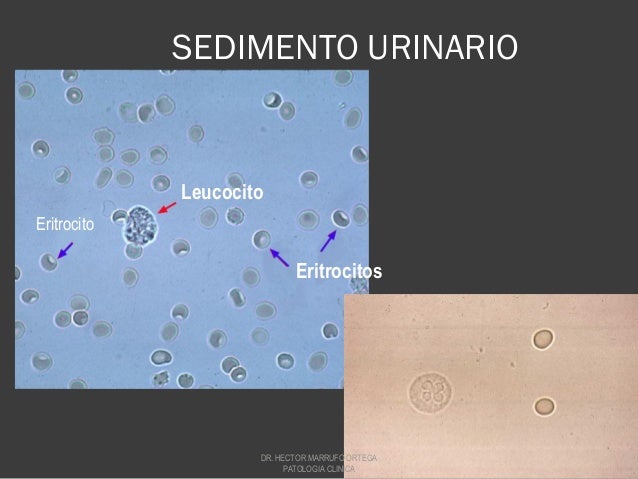Enfermedades del sistema urinario Enfermedades del sistema urinario