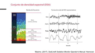 Sedline Monitor Waveforms Sedline y narcotrend.pptx