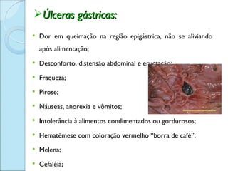 Úlceras gástricas:
   Dor em queimação na região epigástrica, não se aliviando
    após alimentação;
   Desconforto, distensão abdominal e eructação;
   Fraqueza;
   Pirose;
   Náuseas, anorexia e vômitos;
   Intolerância à alimentos condimentados ou gordurosos;
   Hematêmese com coloração vermelho “borra de café”;
   Melena;
   Cefaléia;
 