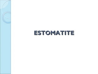ESTOMATITE
 
