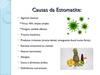 Causas da Estomatite:
   Agentes tóxicos:

    **Vírus: HIV, herpes simples

    **Fungos: candida albicans
   Trauma mecânico;
   Produtos irritantes (creme dental, enxaguante bucal muito forte);
   Estresse emocional ou mental;
   Fatores hormonais;
   Alergias;
   Sucos e alimentos ácidos;
   Deficiências nutricionais;
 