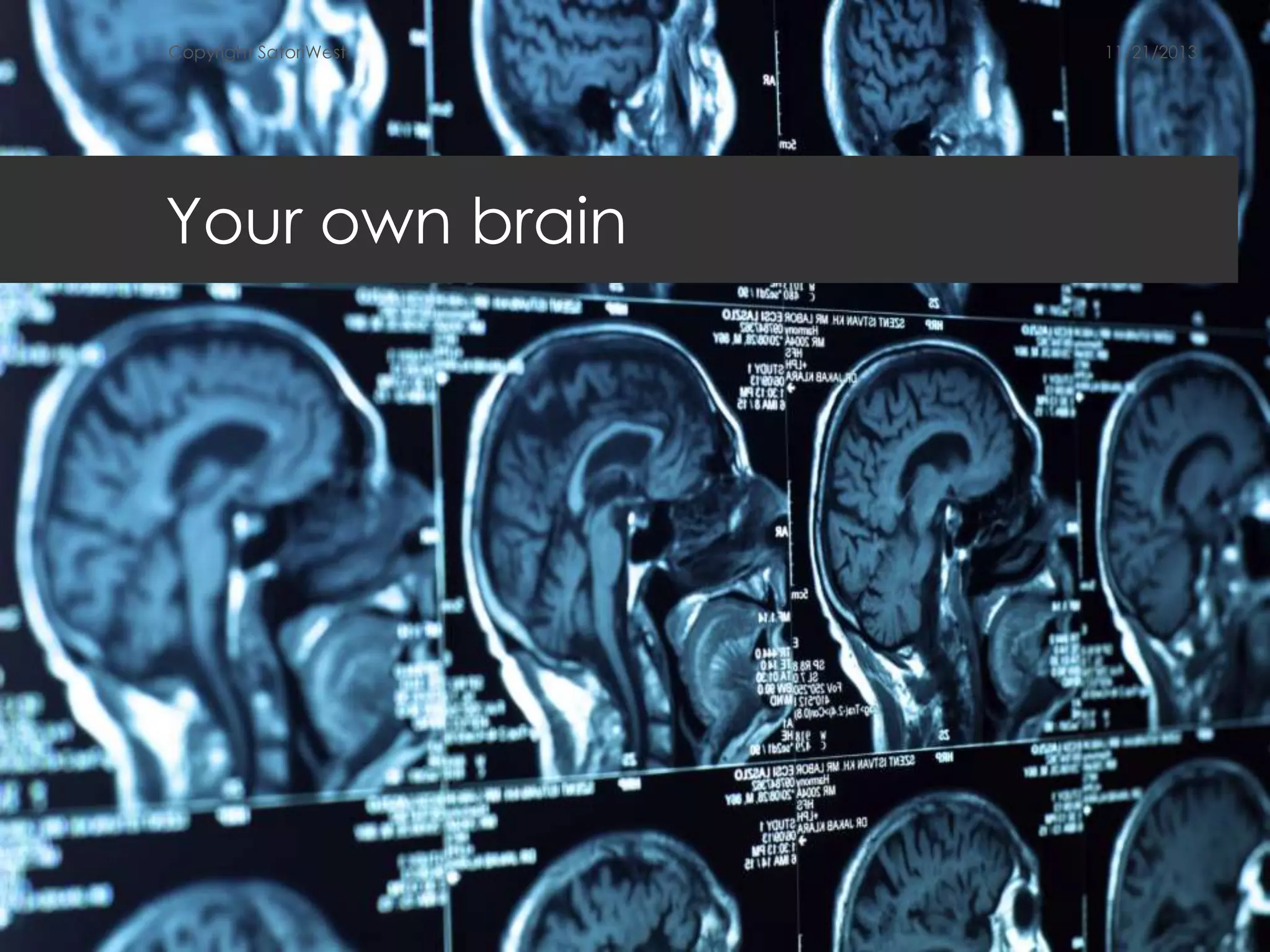 Copyright SatoriWest

Your own brain

11/21/2013

 