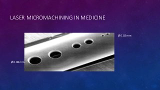 LASER MICROMACHINING IN MEDICINE
Ø 0.08 mm
Ø 0.02 mm
 