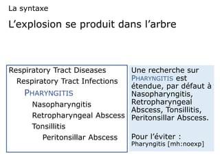 L’explosion se produit dans l’arbre
Respiratory Tract Diseases
Respiratory Tract Infections
PHARYNGITIS
Nasopharyngitis
Retropharyngeal Abscess
Tonsillitis
Peritonsillar Abscess
Une recherche sur
PHARYNGITIS est
étendue, par défaut à
Nasopharyngitis,
Retropharyngeal
Abscess, Tonsillitis,
Peritonsillar Abscess.
Pour l’éviter :
Pharyngitis [mh:noexp]
La syntaxe
 