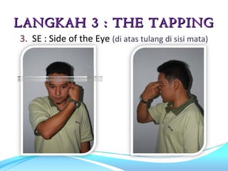 LANGKAH 3 : THE TAPPING
3. SE : Side of the Eye (di atas tulang di sisi mata)
 