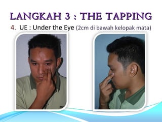 LANGKAH 3 : THE TAPPING
4. UE : Under the Eye (2cm di bawah kelopak mata)
 