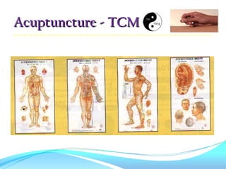 Acuptuncture - TCM
 