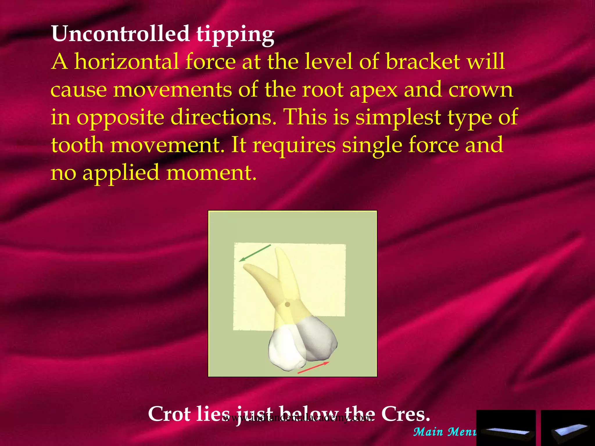 Uncontrolled tipping
A horizontal force at the level of bracket will
cause movements of the root apex and crown
in opposite directions. This is simplest type of
tooth movement. It requires single force and
no applied moment.
Crot lies just below the Cres.
Main Menu
www.indiandentalacademy.com
 